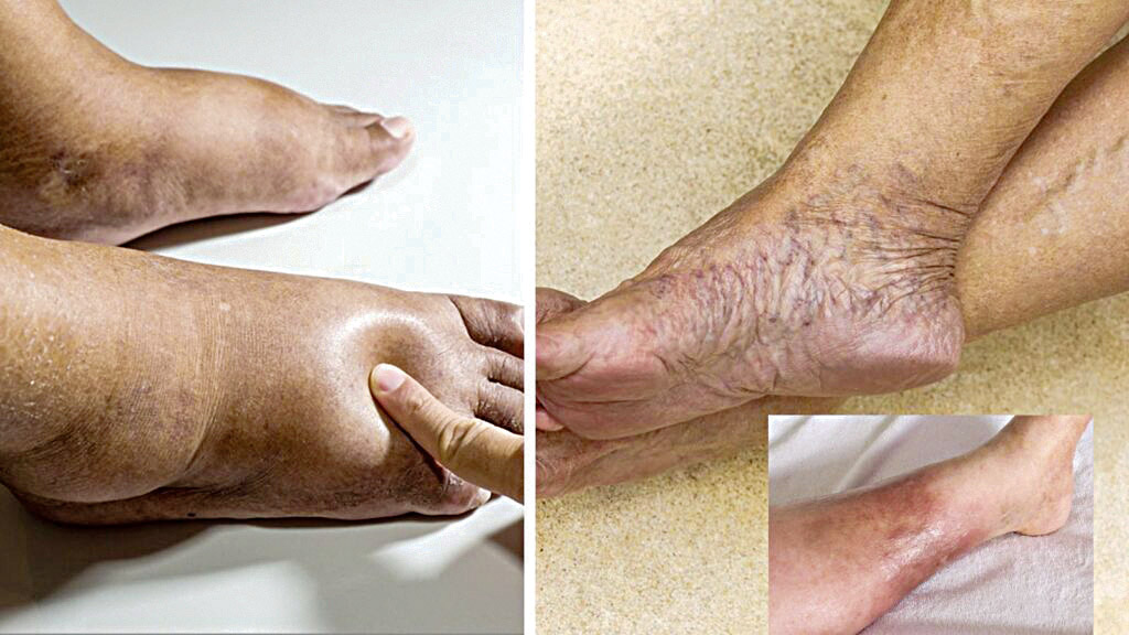 The silent signs below the ankles